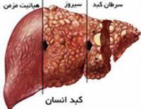پاورپوینت کبد و بیماری های آن