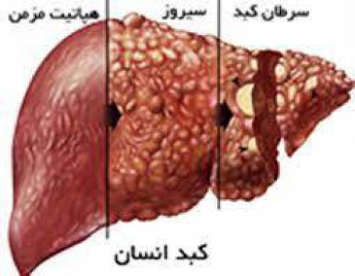 پاورپوینت کبد و بیماری های آن